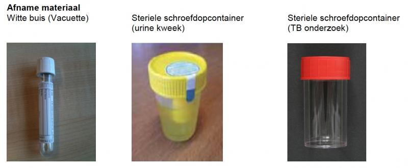 Hoe Lang Moet Urine Op Kweek Staan